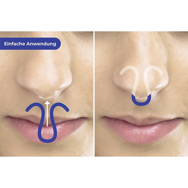 Klipsy przeciw chrapaniu zestaw 3 szt. – Maximex-image-1